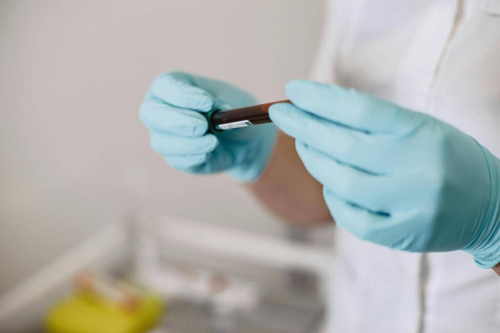 The Role of Lab Testing in Customized Weight Loss Plans