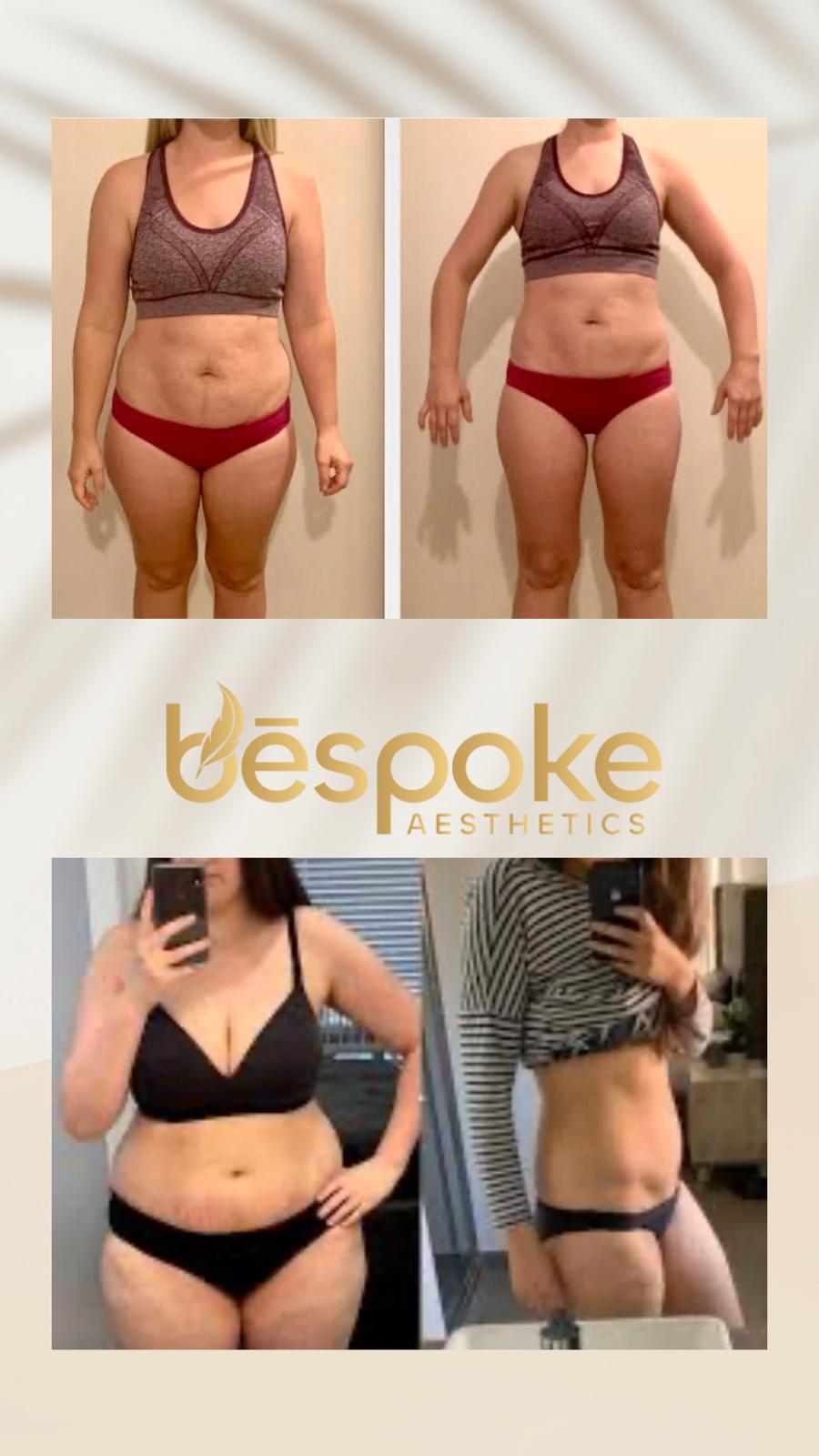 Medical weight loss before and after, Bespoke Aesthetics Gainesville Florida